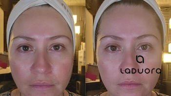 LADUORA Velve 4-in-1 Skincare Wand Review
