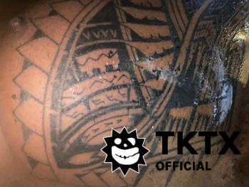TKTX Official® TKTX Bedövande Gel för Underbehandling 15 ml Recension