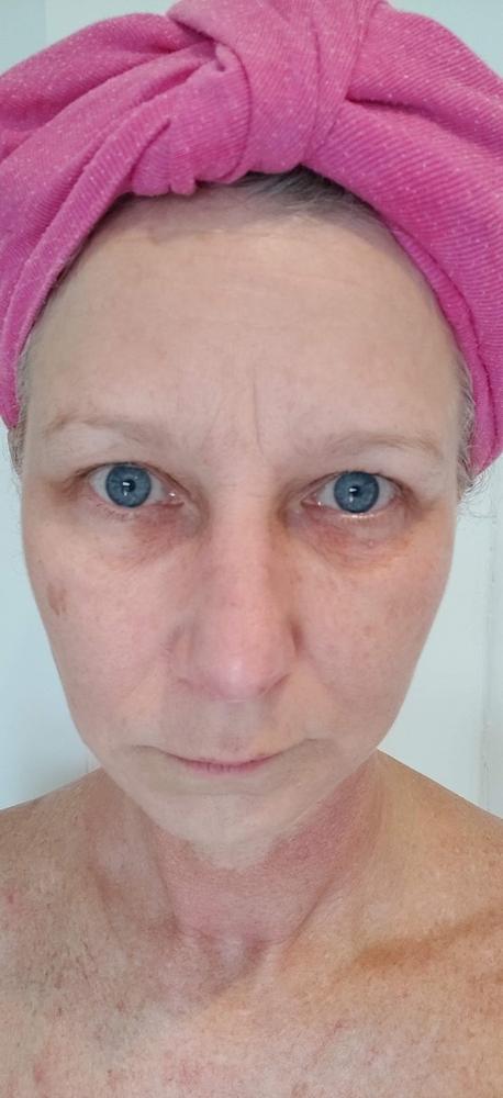 Seoulista Super Hydration Instant Facial® - Customer Photo From Aoife