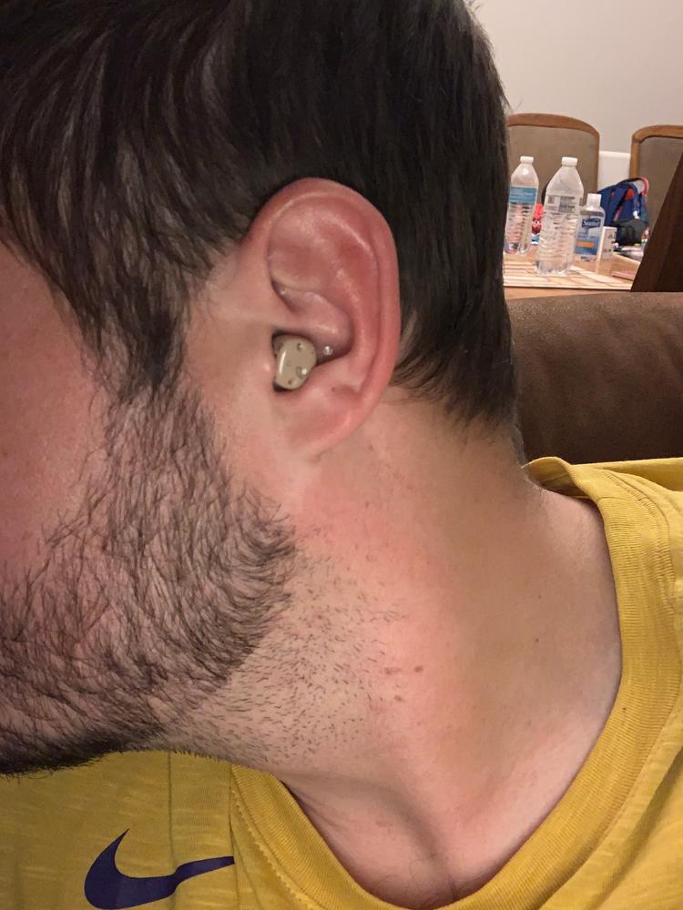 Audien EV1 Rechargeable CIC Hearing Aids (FULL PAIR) 40 OFF