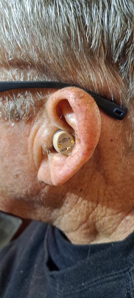 Audien EV1 Hearing Aid (Pair) - Customer Photo From Brent Heenan