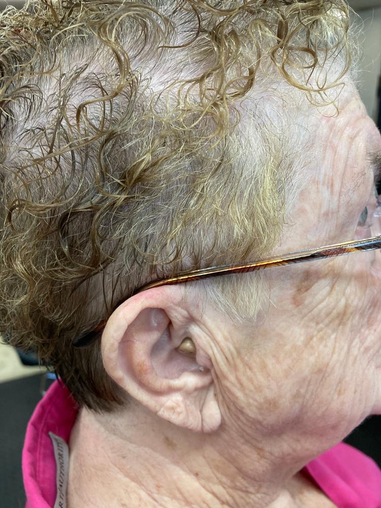 Best cheap hearing aid under 100 audien hearing