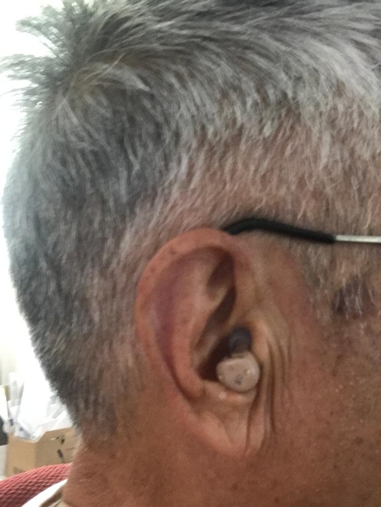 Audien EV3 Hearing Aid (Pair) - Customer Photo From Stephen Cheng