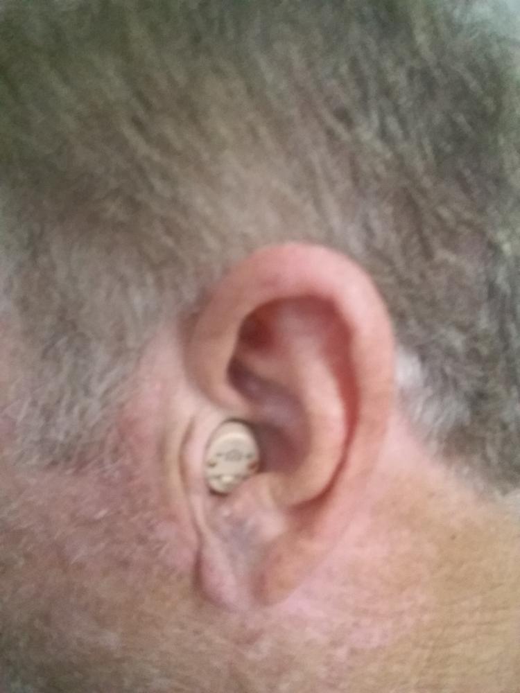 Audien EV3 Hearing Aid (Pair) - Customer Photo From TOM SARTORI