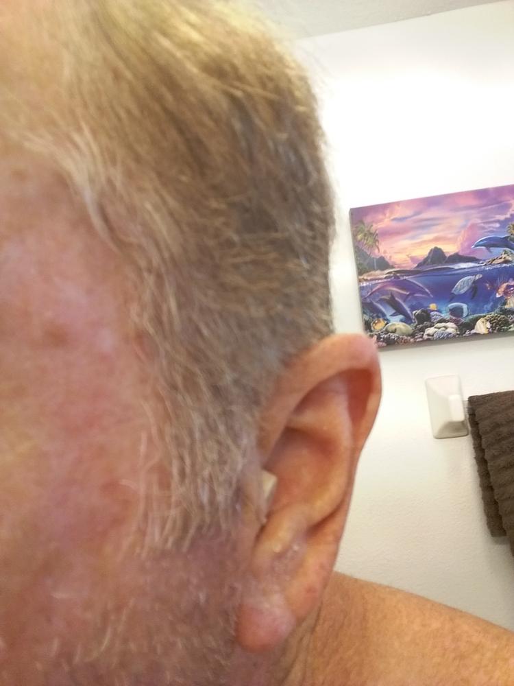 Audien EV3 Hearing Aid (Pair) - Customer Photo From TOM SARTORI