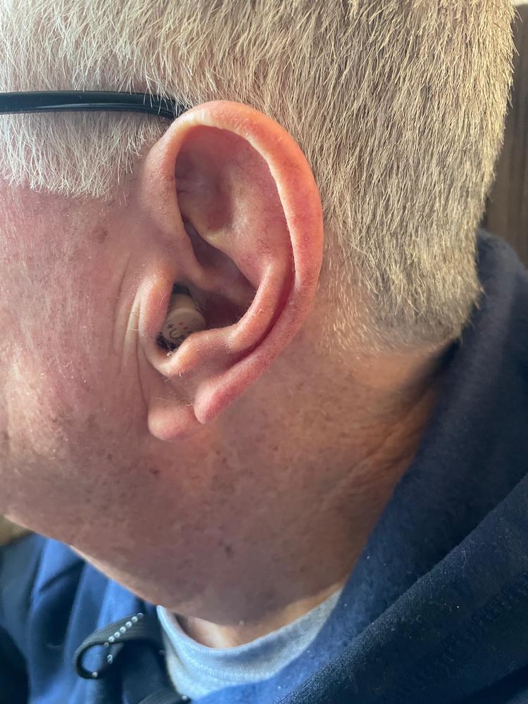 Audien Atom Pro OTC Hearing Aid (Pair) - Customer Photo From Richard Adams