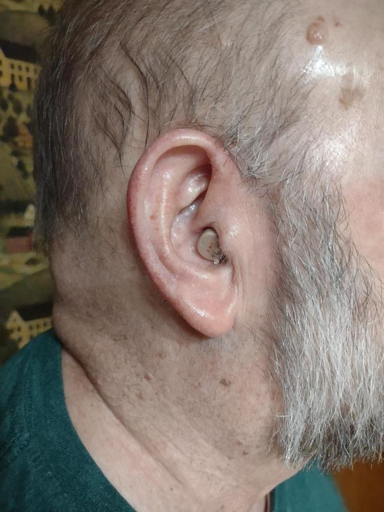 Audien Atom OTC Hearing Aid (Pair) - Customer Photo From Rick 