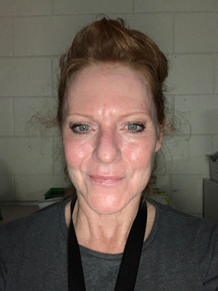 Deep Detox Facial in a Box - Customer Photo From Pamela Sack