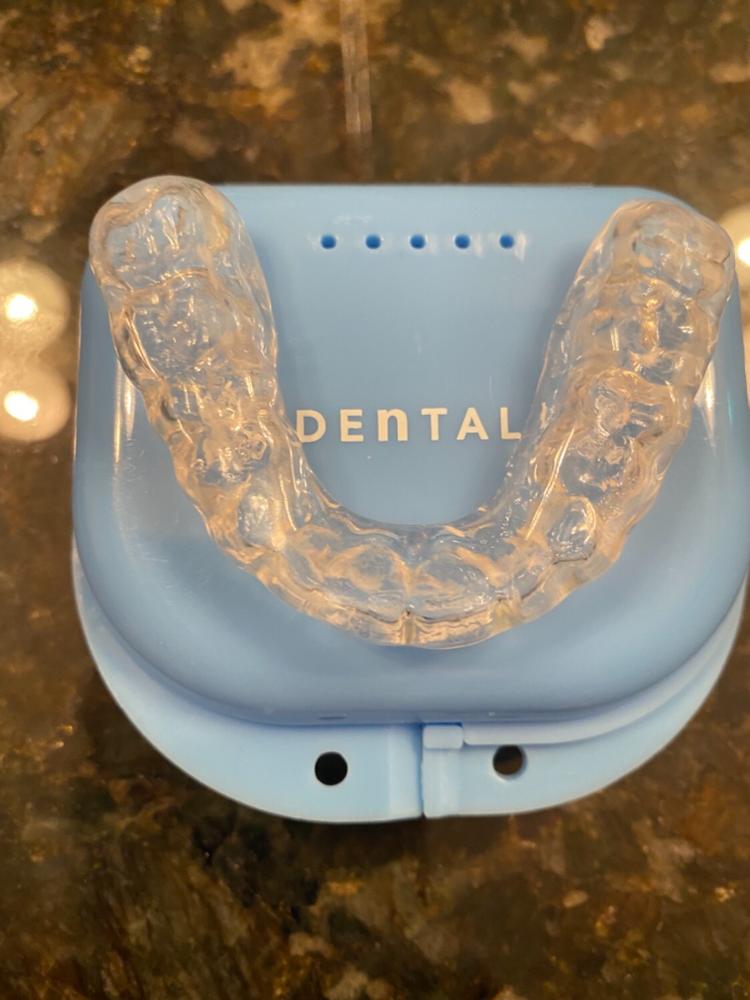 Premium 3D - Ultimate Protection - Requires Upper and Lower Impressions - Customer Photo From William Webb