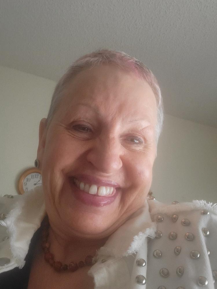 Total Package Serum - Customer Photo From Brenda Blackburn