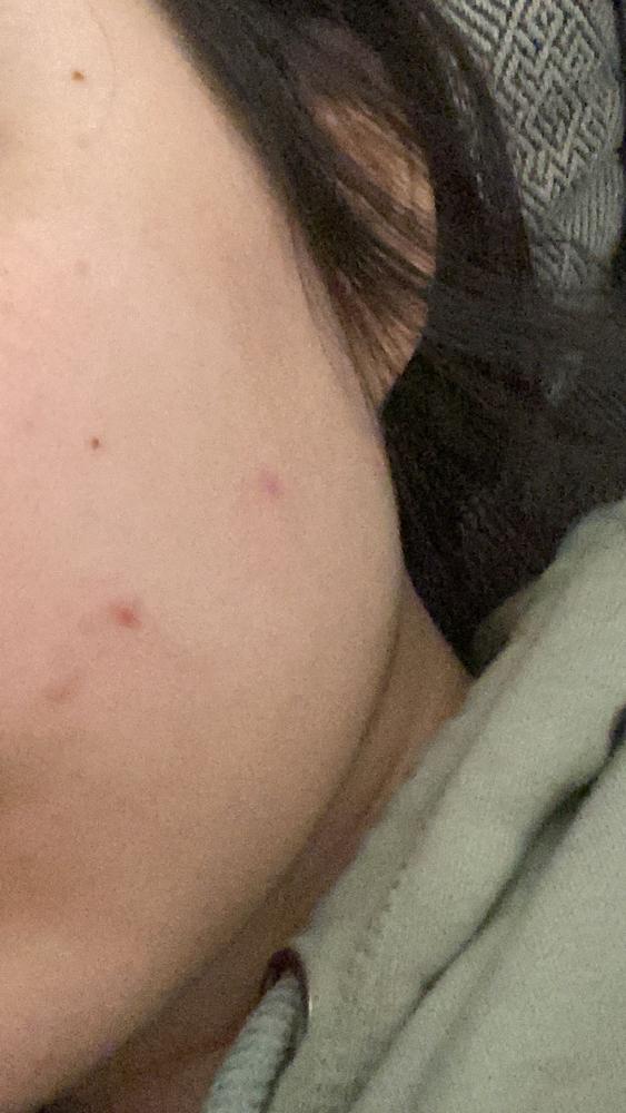 Red Foam Cleanser - Customer Photo From Jamie