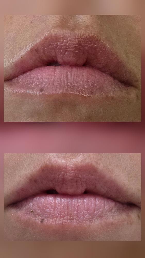 Close-up of lips before and after using the balm