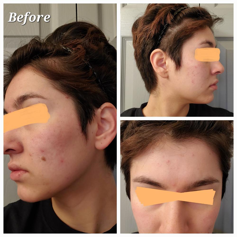 Carrotene IPMP™ Quick Dry Pore Tightening Clay Mask - Customer Photo From Catalina