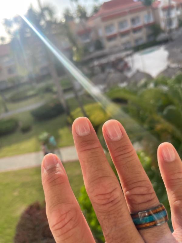 Black Zirconium 10mm Ring with Azure Blue Opal & Hawaiian Koa Wood Tri-Inlay - Dome Shape, Comfort Fitment - Customer Photo From Mark Wilson
