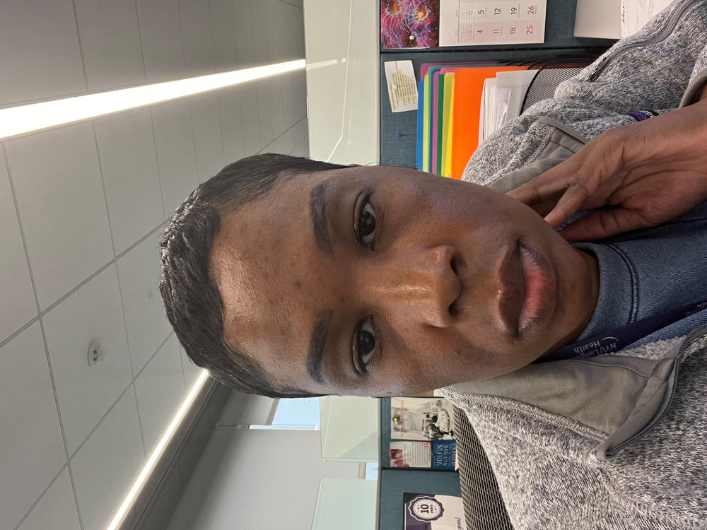 SuperFruit Brightening Cleanser - Customer Photo From Georgia Sergeant