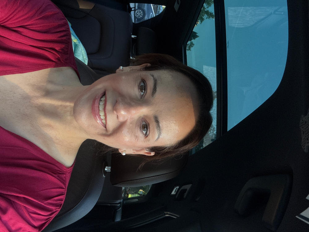 Even Tone 4-Step Regimen ($239 Value) - Customer Photo From Shannon Weisman