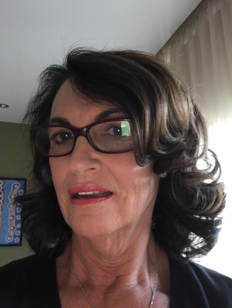 Hair Growth Vitamins - Customer Photo From Ruth Breckler