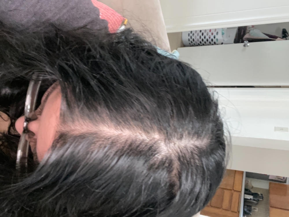 3-Month Hair Growth Supply - Customer Photo From Brittanie Quintero
