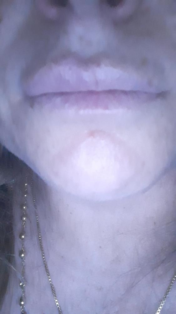 SUPER PUFFY LIPS - Customer Photo From Marisa Pizzo