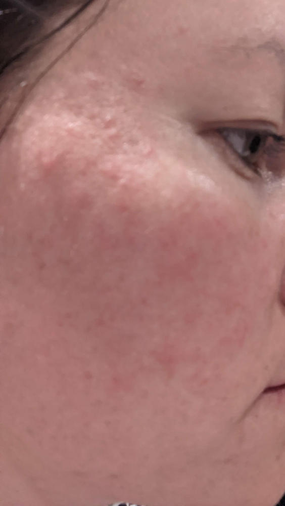 tbh skincare chemist warehouse