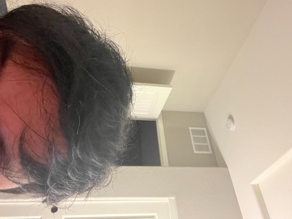 3-in-1 Hair Growth Formula - Customer Photo From Alex Kunvatanagarn