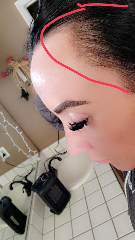 iRESTORE Elite - Customer Photo From Alyssa Zepeda