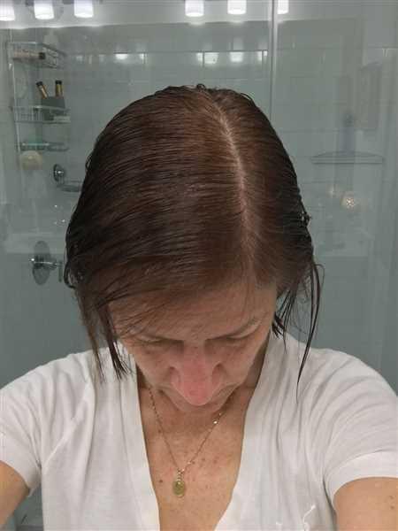 iRESTORE Professional - Customer Photo From Lilette Daumas