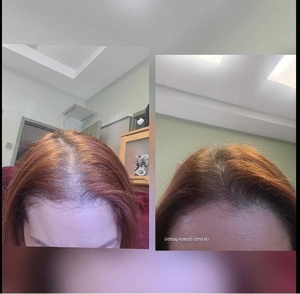 iRESTORE Professional - Customer Photo From Haley Norman