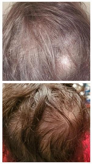 iRESTORE Professional - Customer Photo From Girl On Fire