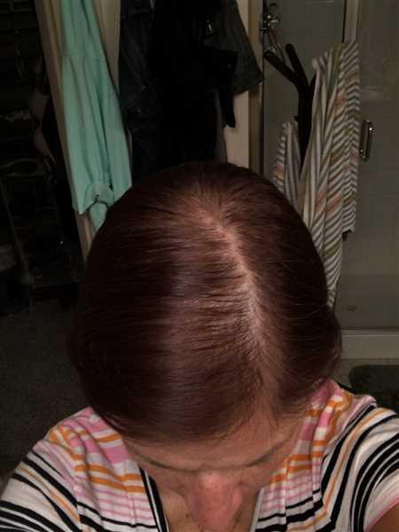 iRESTORE Professional - Customer Photo From Lilette Daumas