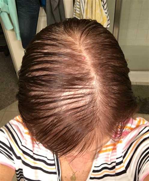 iRESTORE Professional - Customer Photo From Lilette Daumas