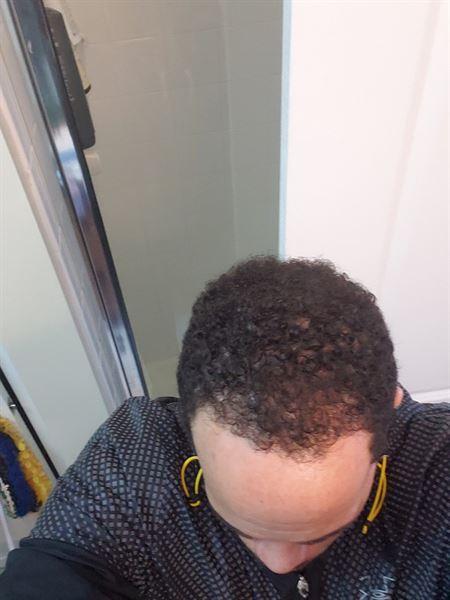 REVIVE Thickening Conditioner - Customer Photo From Larry Helton
