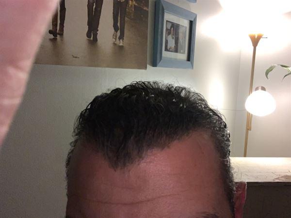 REVIVE Growth Activator Serum - Customer Photo From Marios Ellinas