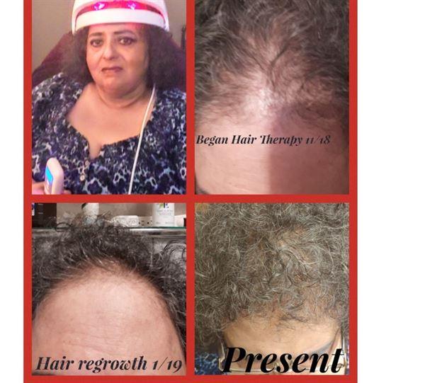 REVIVE Growth Activator Serum - Customer Photo From Gina G.