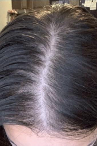REVIVE Advanced Hair Growth Formula - Customer Photo From Jesse Chang