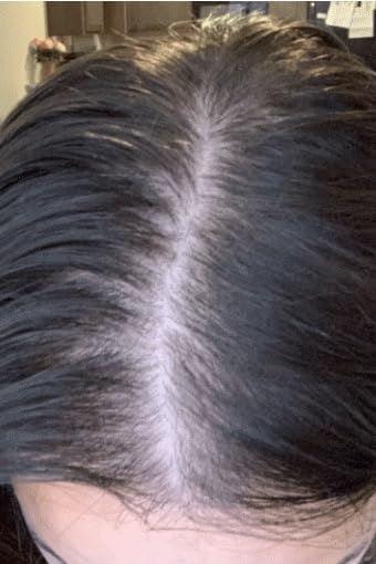 REVIVE Advanced Hair Growth Formula - Customer Photo From Jesse Chang