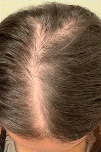 REVIVE Advanced Hair Growth Formula - Customer Photo From Jesse Chang