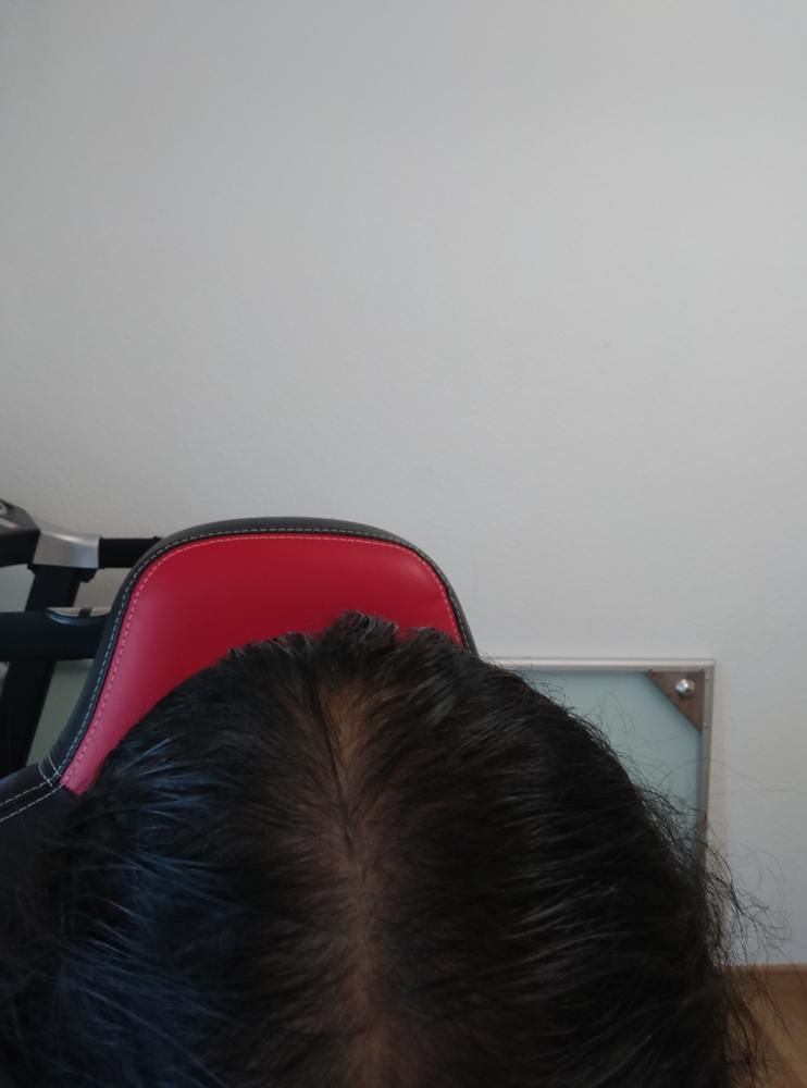 3-in-1 Hair Growth Formula - Customer Photo From Sarbani Mohan
