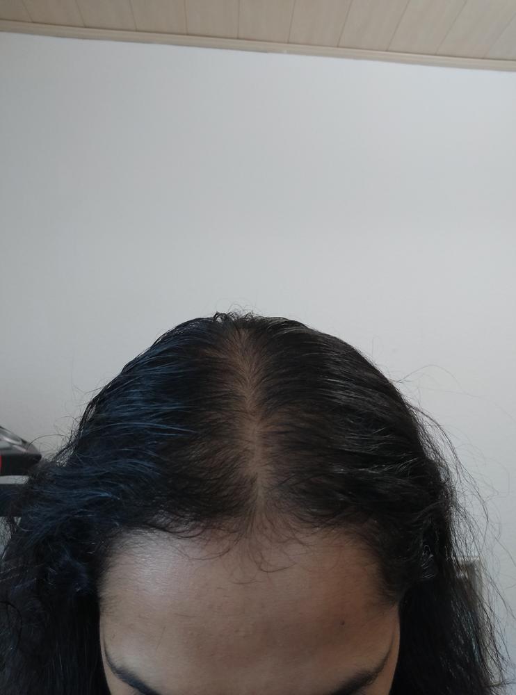 3-in-1 Hair Growth Formula - Customer Photo From Sarbani Mohan