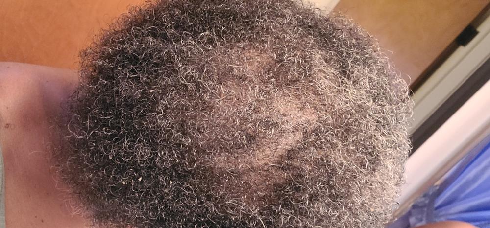 Anti-Hair Loss Serum - Customer Photo From Michele London