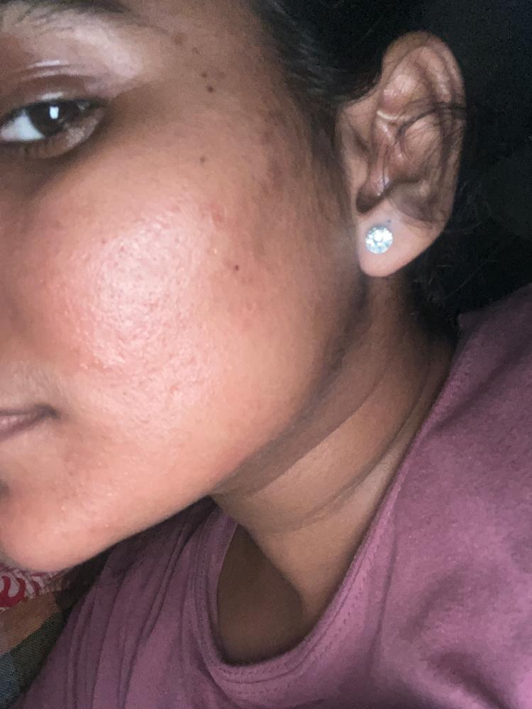 Hydrate & Repair Duo - Customer Photo From Spandan P.