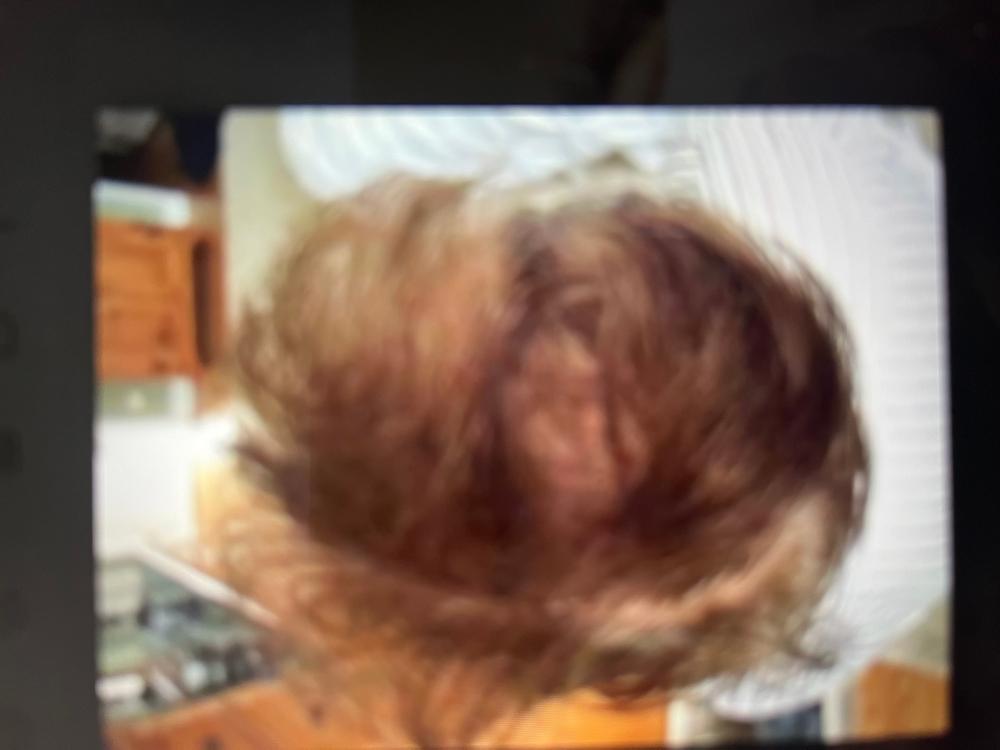 TruVarin Enriched Hair Growth Formula - Customer Photo From Carolyn Gallagher