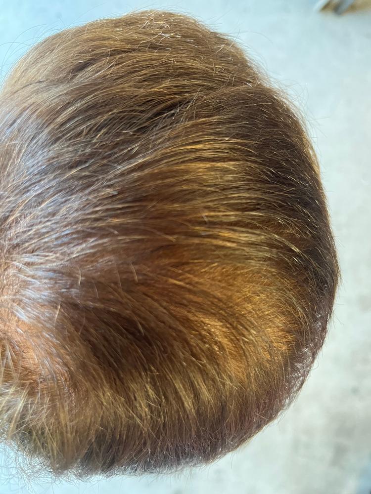 TruVarin Enriched Hair Growth Formula - Customer Photo From Carolyn Gallagher