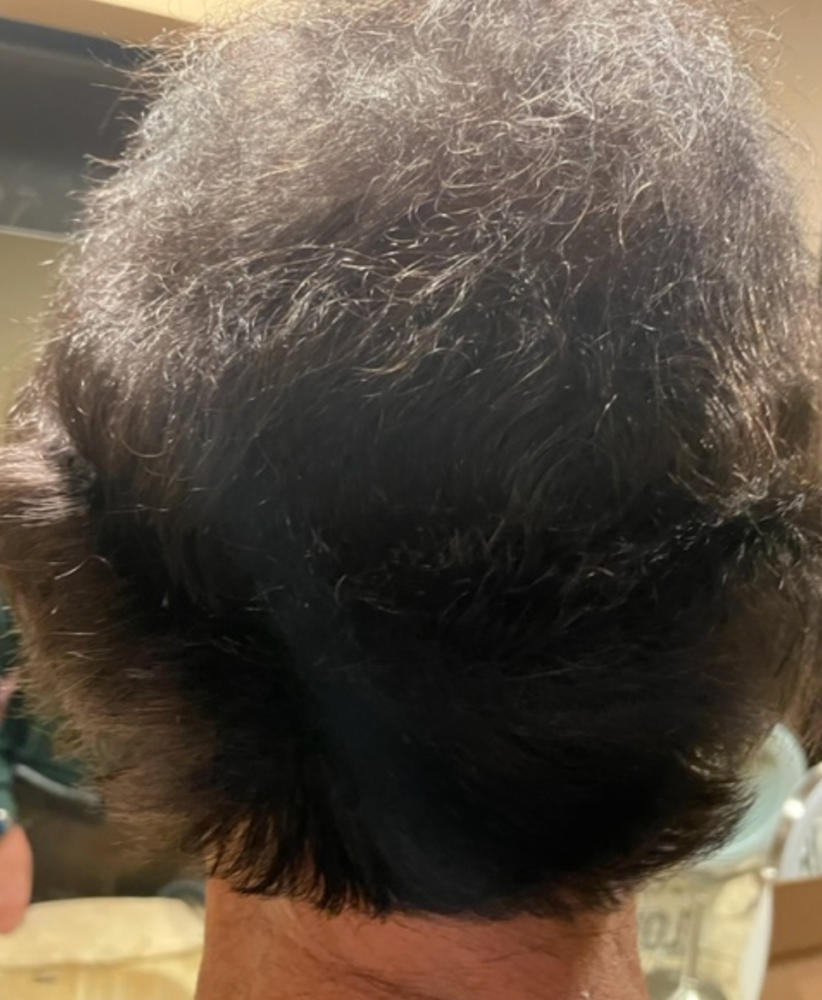 TruVarin Enriched Hair Growth Formula - Customer Photo From Kenneth