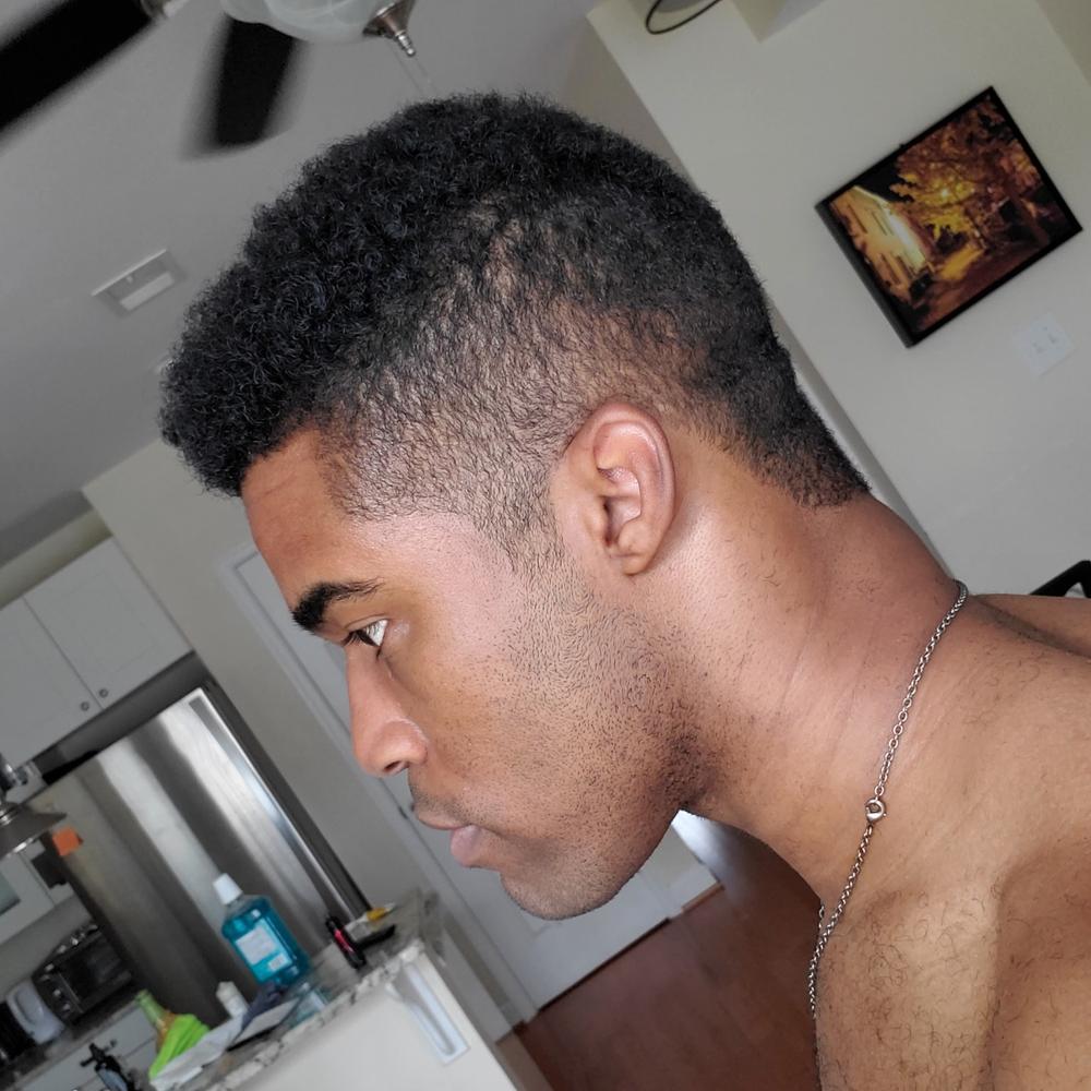 PATENTED HAIR REGROWTH SYSTEM FOR MEN - Customer Photo From William Knox