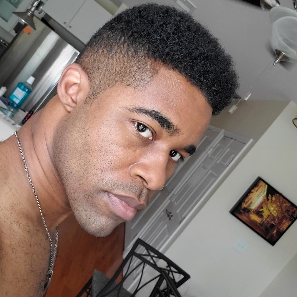 PATENTED HAIR REGROWTH SYSTEM FOR MEN - Customer Photo From William Knox
