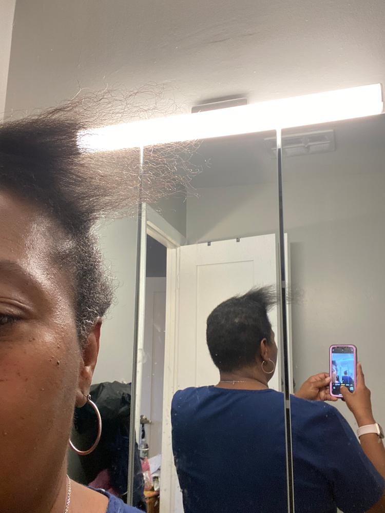 PATENTED HAIR REGROWTH SYSTEM FOR WOMEN - Customer Photo From Darlene