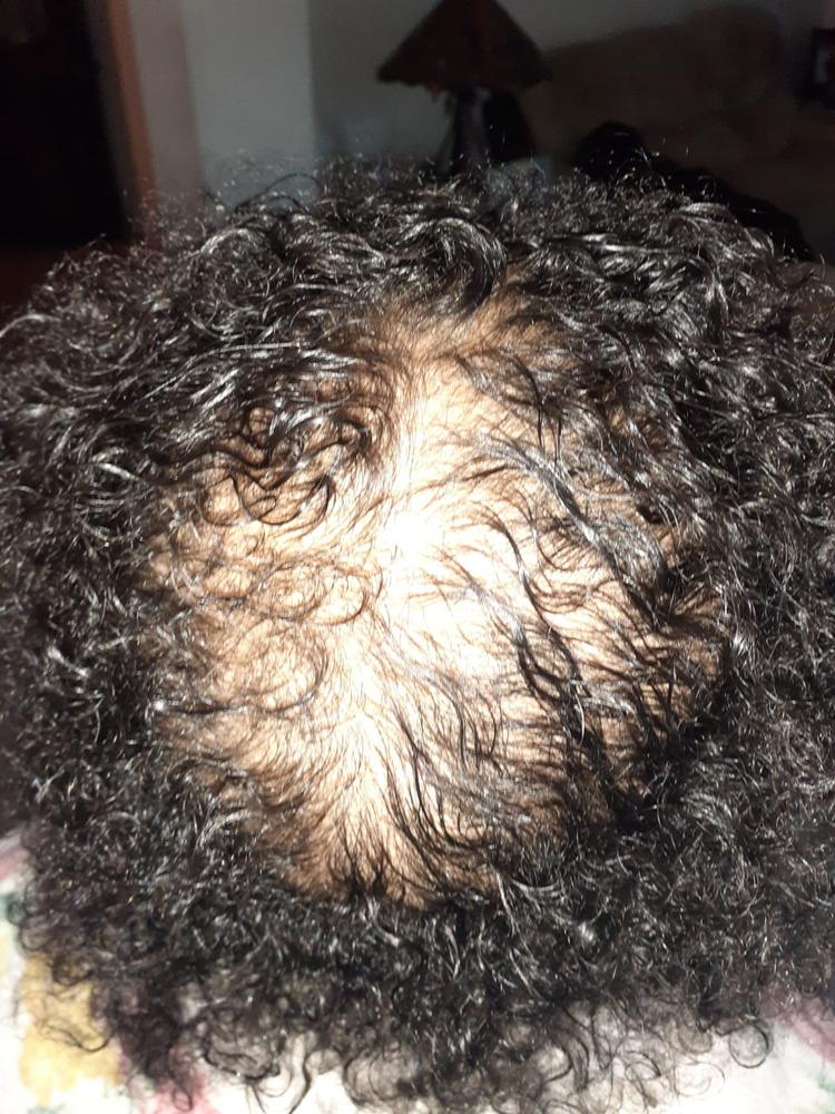 ScalpMED® Essentials (Hair Care Essentials Kit) - Customer Photo From Rodlaine D.