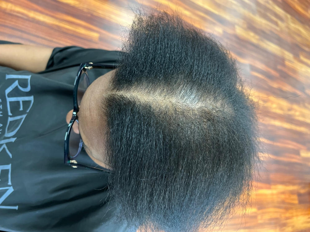PATENTED HAIR REGROWTH SYSTEM FOR WOMEN - Customer Photo From Jeanette Powell