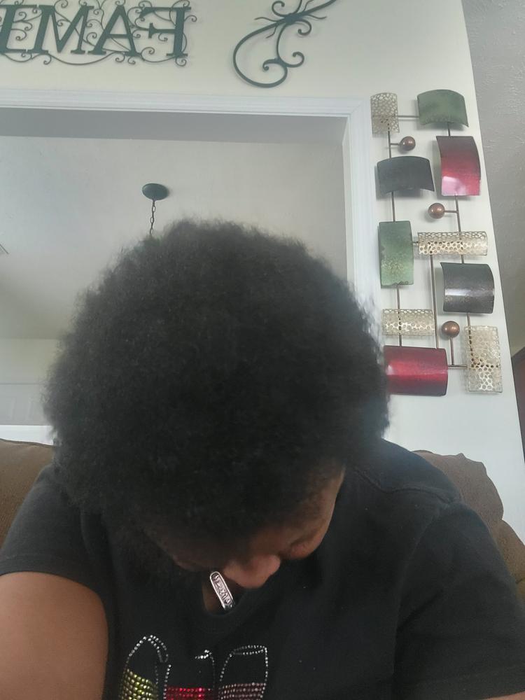 ScalpMED® Essentials (Hair Care Essentials Kit) - Customer Photo From Sylvia Graham